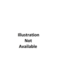 4141328000-BUSHING-BAL/SHAFT,FRT